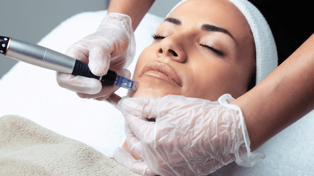 Demapen Microneedling behandling